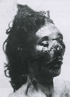 Jack the Ripper Victim - Catherine Eddowes.