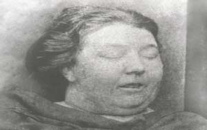 The mortuary photo of Martha Tabram.